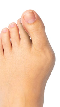 Before - Después de 3 meses el cambio ha sido enorme